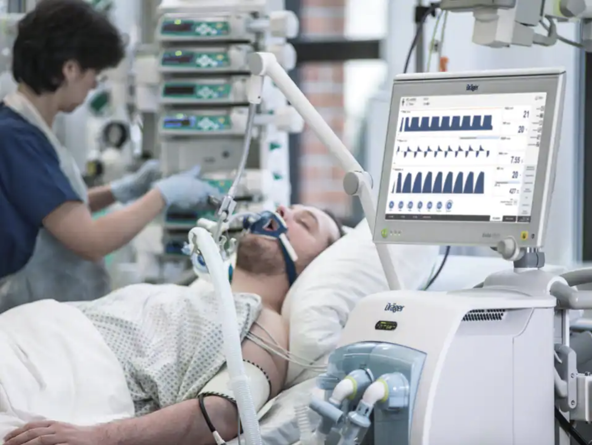 Pressure Vs Volume Controlled Ventilation