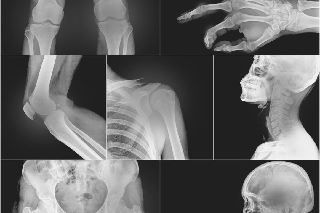 medical-imaging-considerations-for-the-industrial-athlete