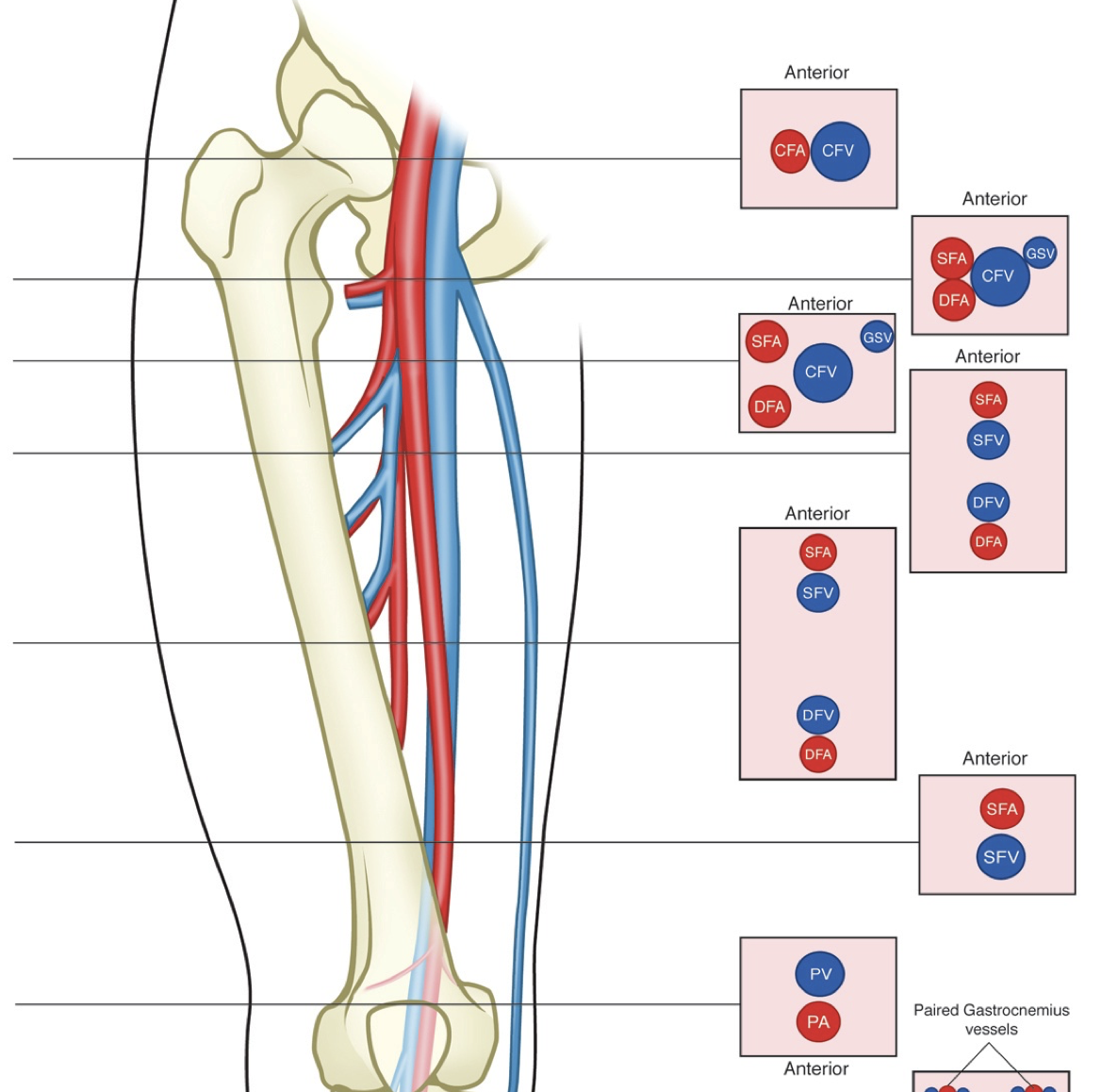Lower Extremity DVT Ultrasound Online POCUS Course