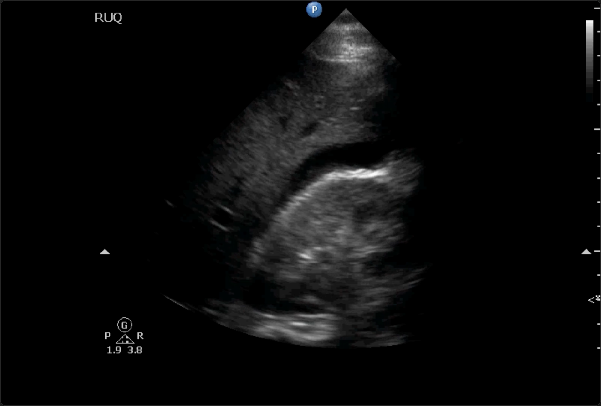 Emergency Medicine eFAST Examination Online POCUS Course