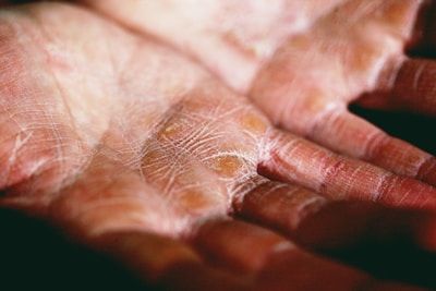 "Close-up of a person's open hands showing detailed palm lines and skin texture."