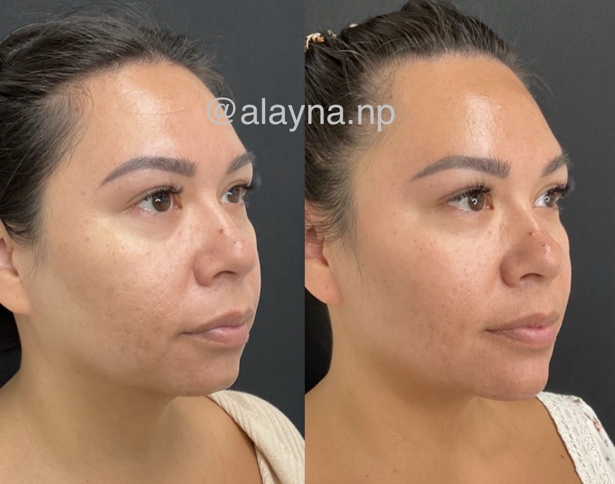 How to become an aesthetic injector