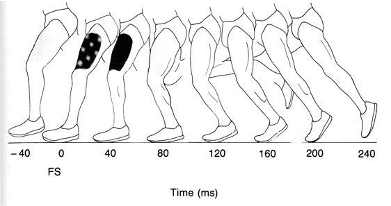 Extensor Contraction A Lesson in Inquiry: The Extensor Paradox Revisited