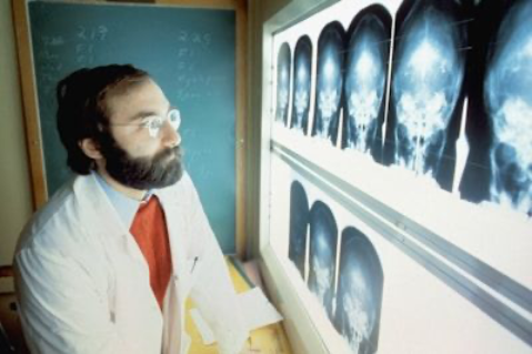 man looking at brain xrays