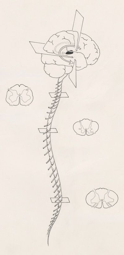 diagram of spinal cord and brain