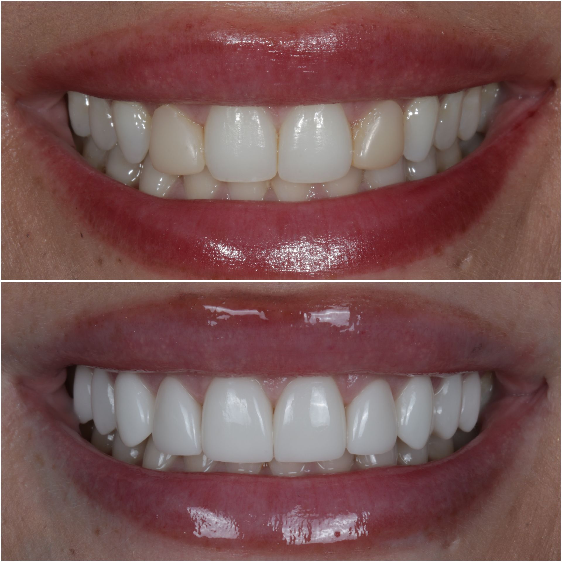 Documented cosmetic case 4