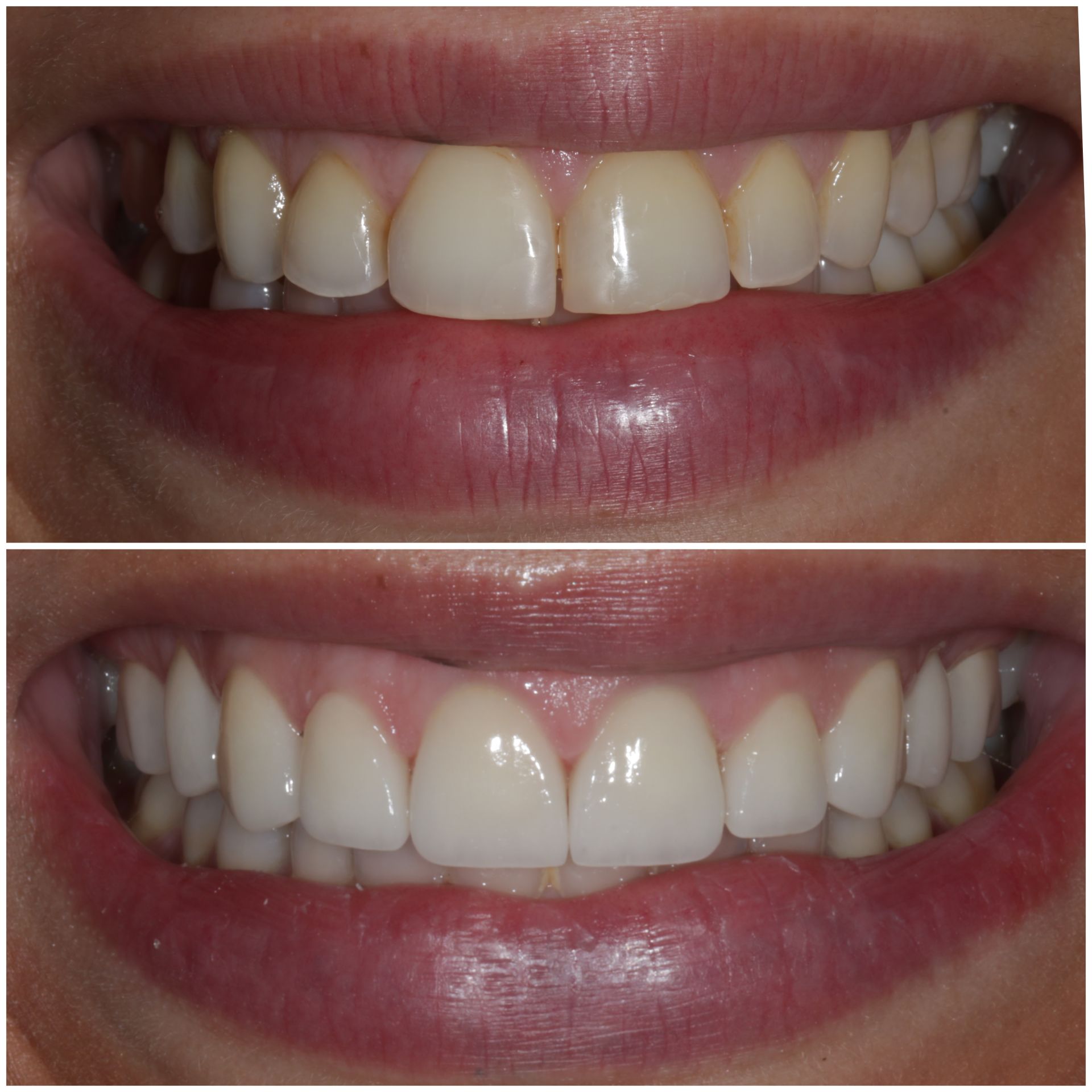 Documented cosmetic case 3