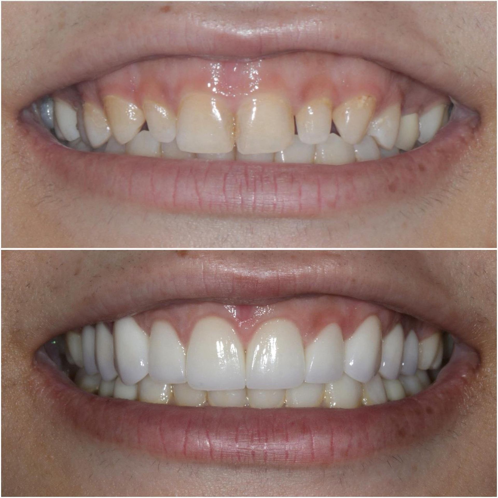 Documented cosmetic case 2