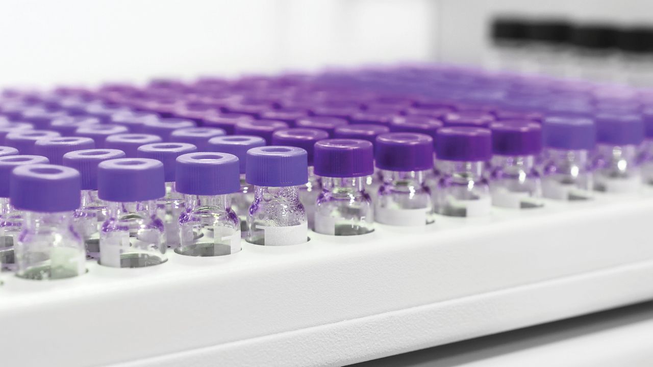 An image of sample vials set up for analysis
