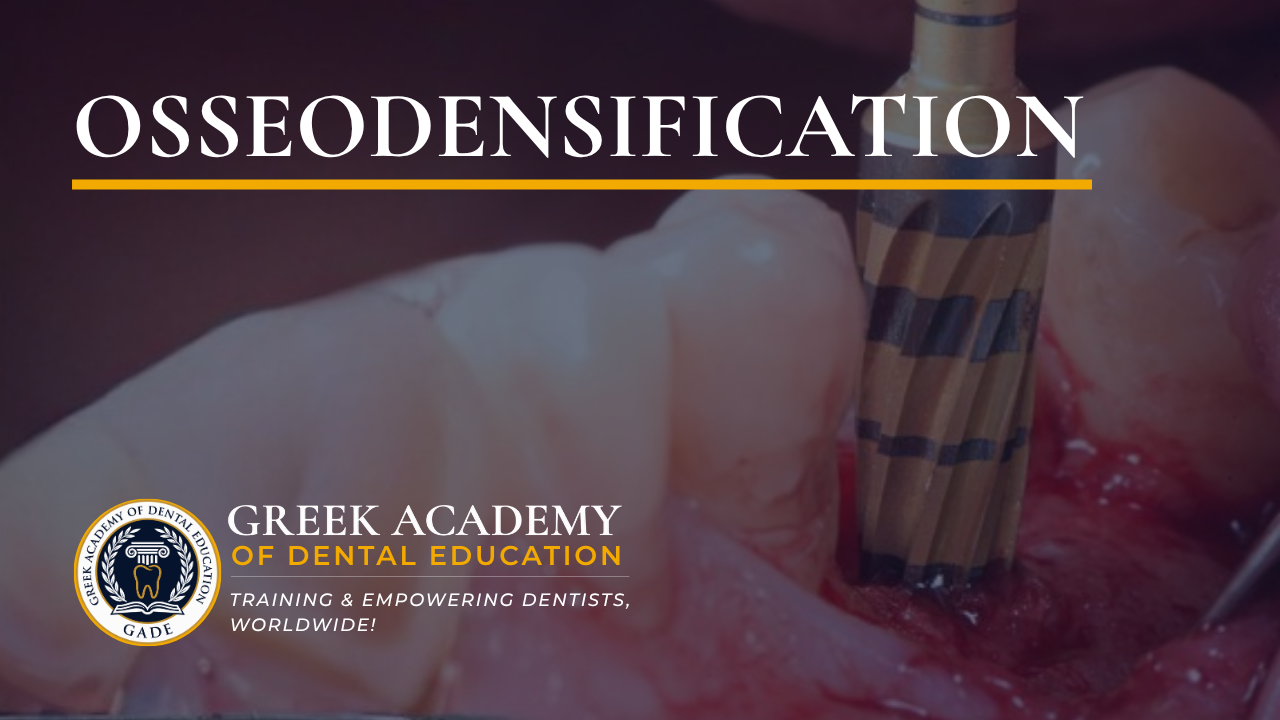 Osseodensification — An Innovative Drilling Technique