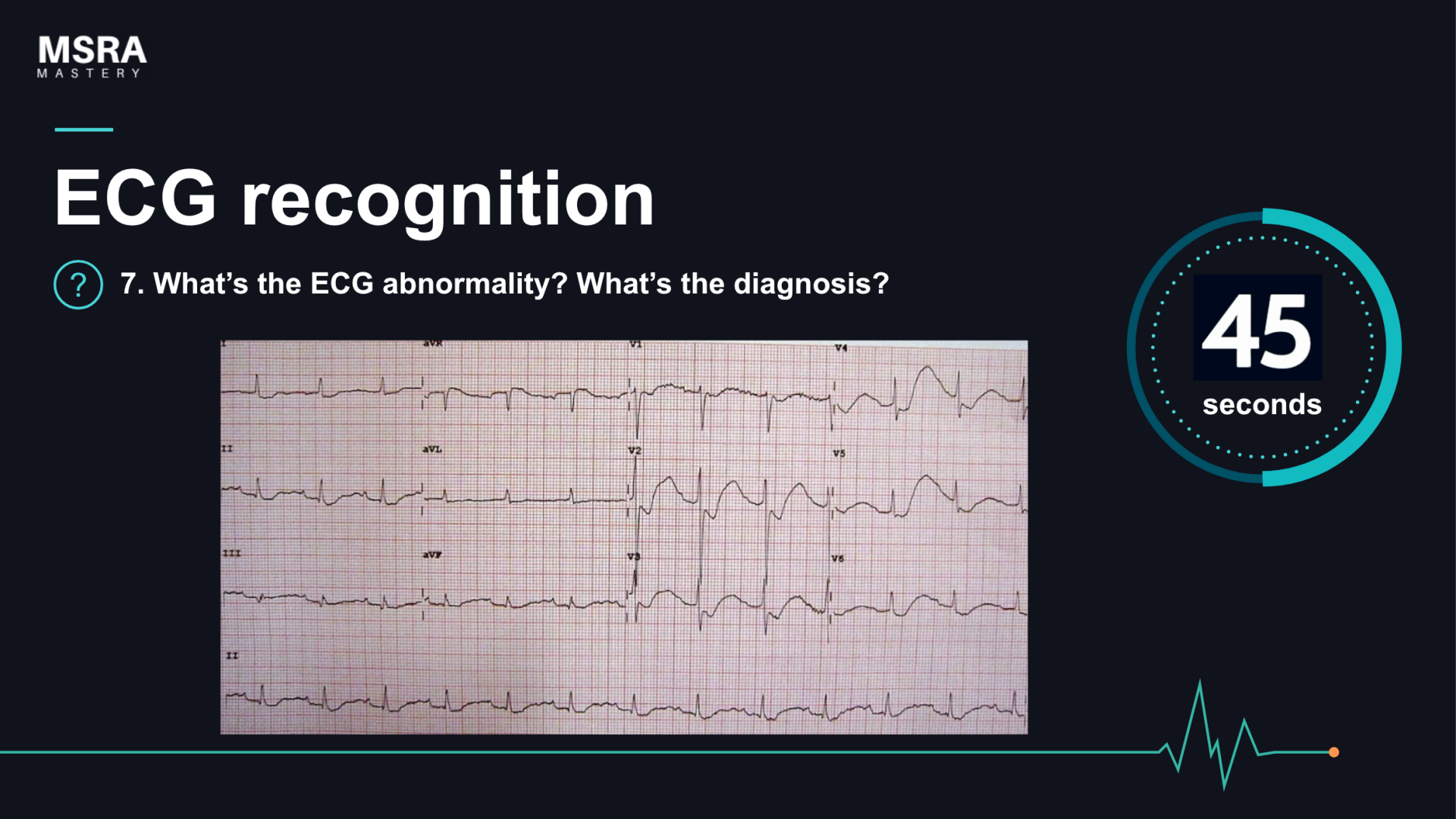 MSRA Mastery Cardiology: ECG recognition; Cameo-free course preview