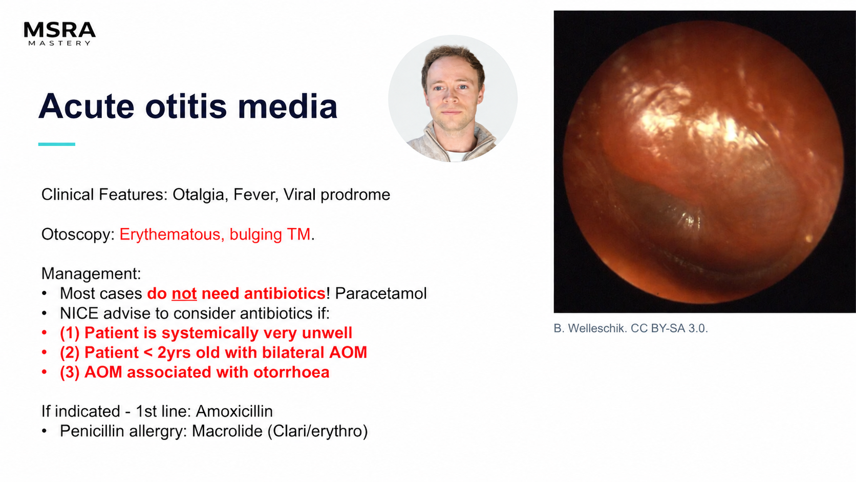 MSRA Mastery ENT: Acute otitis media; course preview with Dr Sam Gordon’s presenter portrait