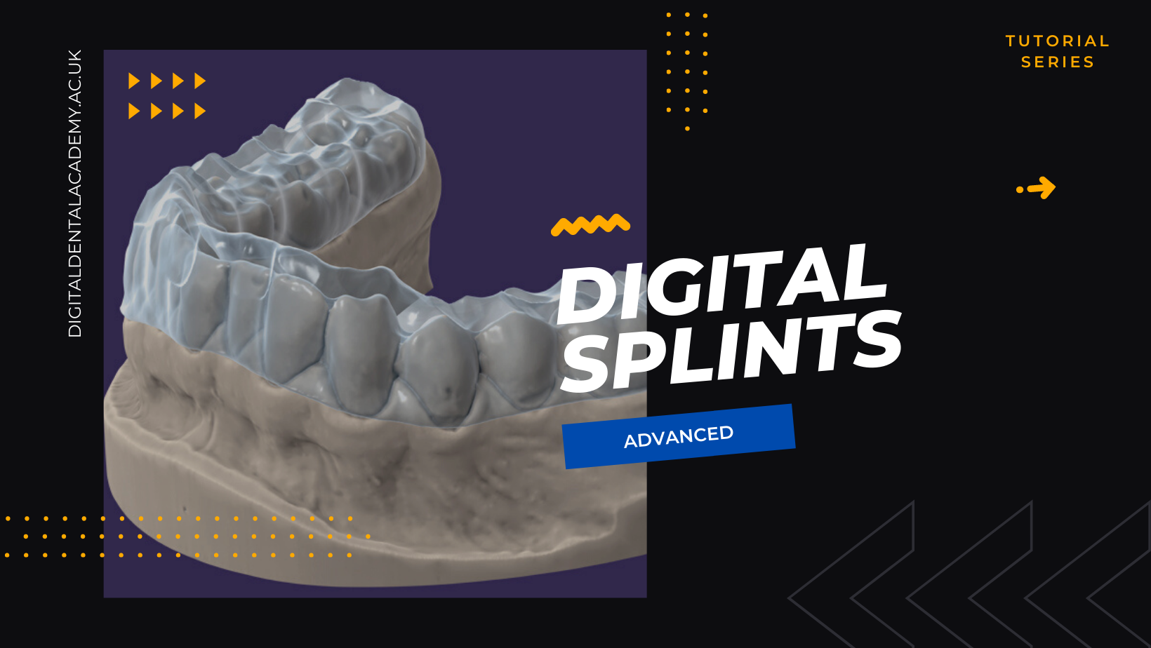 16. Digital Splints