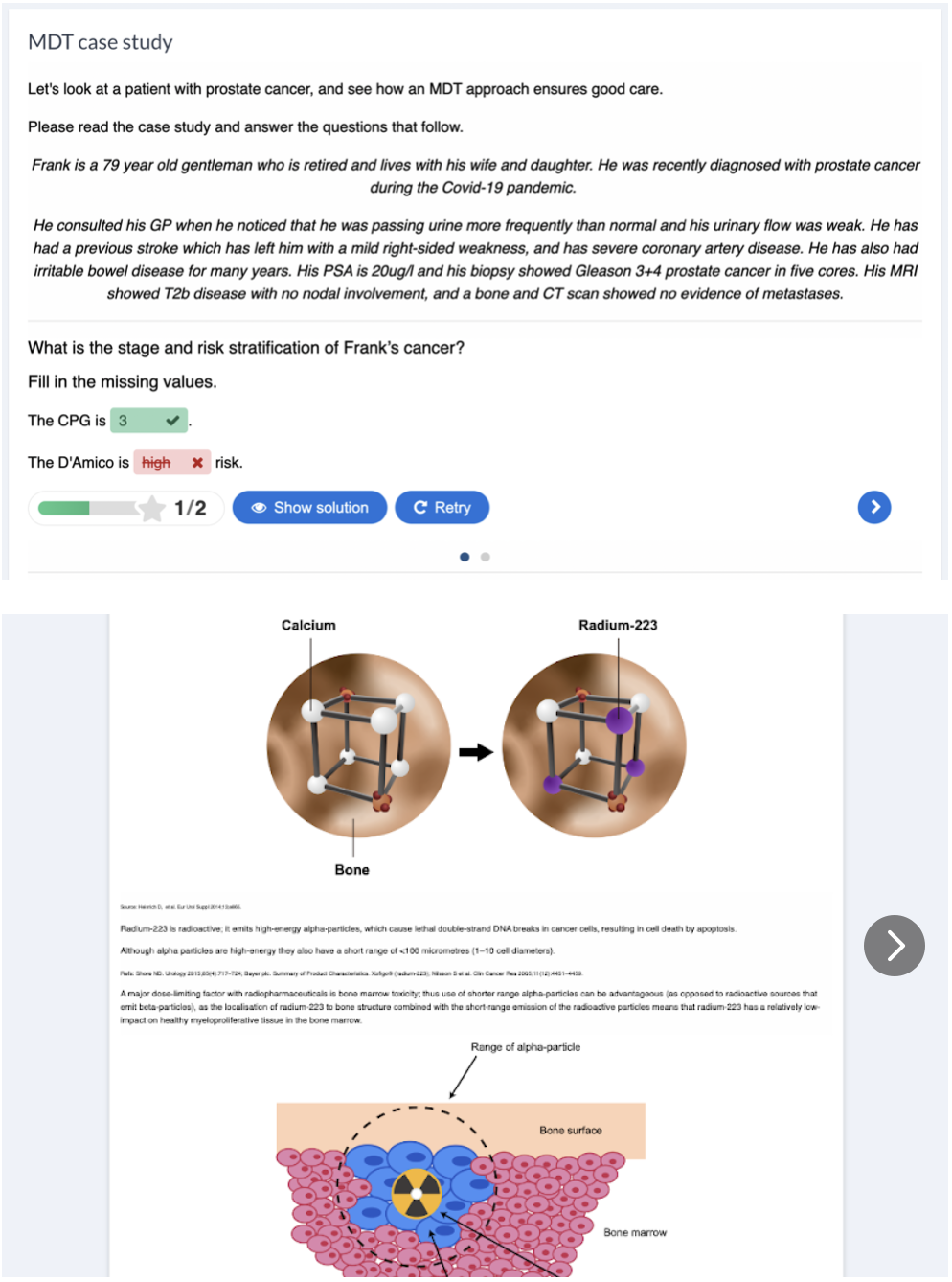 prostate-cancer-care-online-training-module-guy-s-cancer-academy