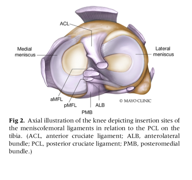 Prevalencia biomecánica y patologías de los ligamentos meniscofemorales una revisión sistemática