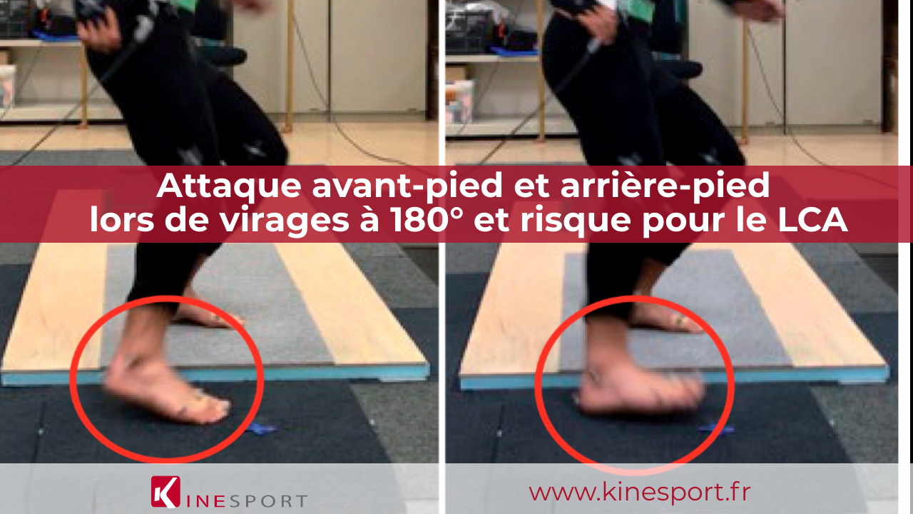 Différences des activités entre l’attaque avantpied et l’attaque arrièrepied Kinesport
