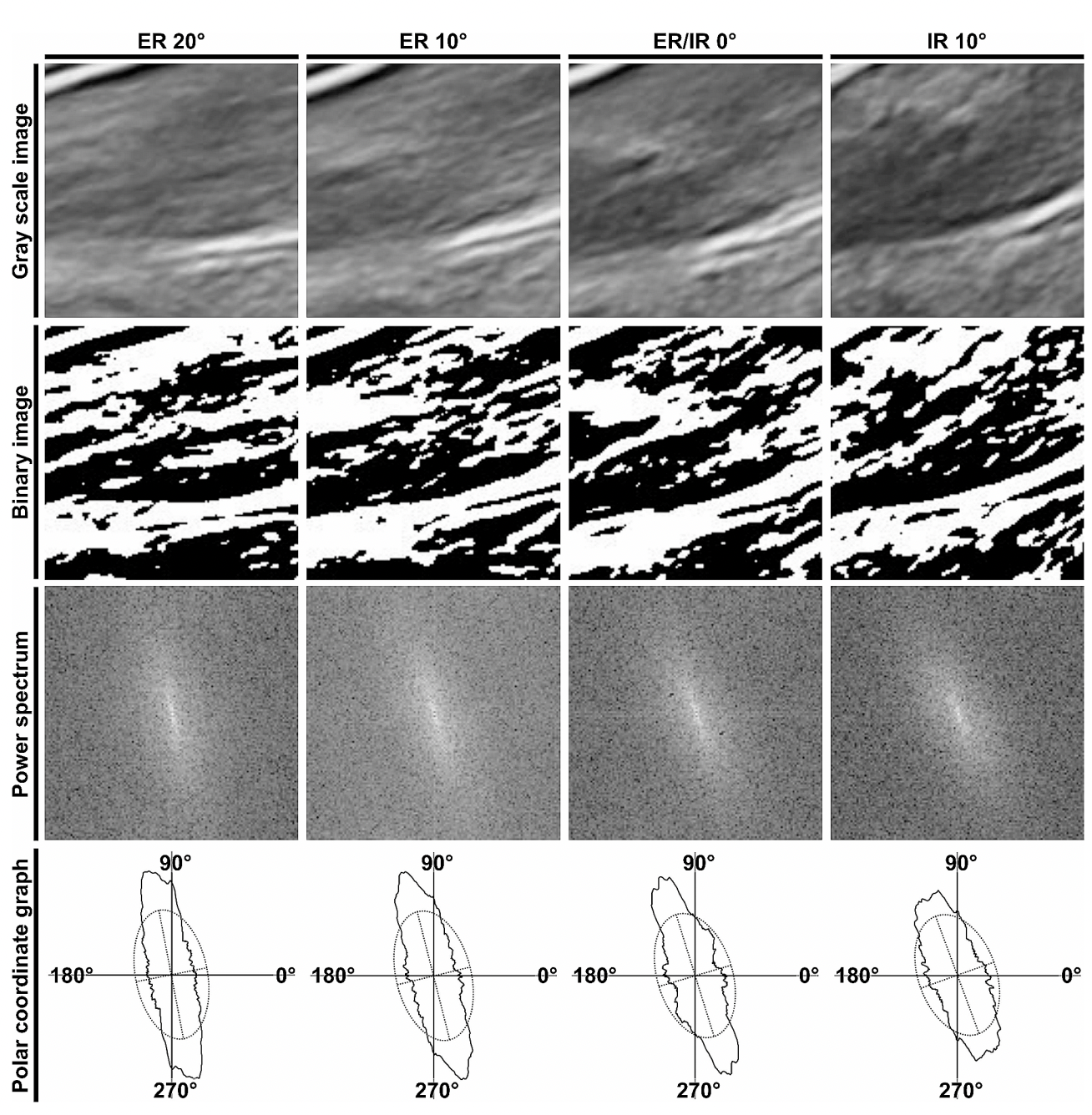 Cette figure illustre le processus d’analyse des images échographiques dans le groupe présentant un test FADIR positif (Flexion, Adduction, Internal Rotation)