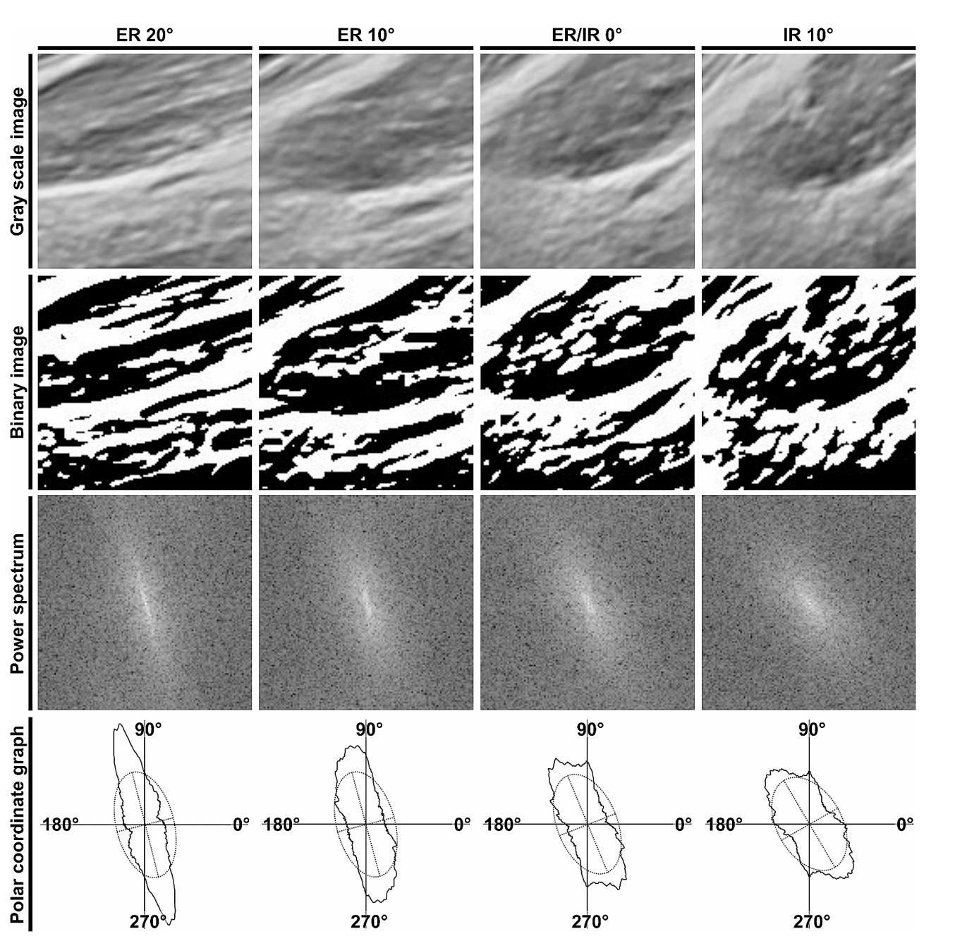 Mesures d'orientation du gluteus minimus et de la capsule articulaire dans le groupe contrôle. L'analyse des images échographiques dans le groupe contrôle est présentée