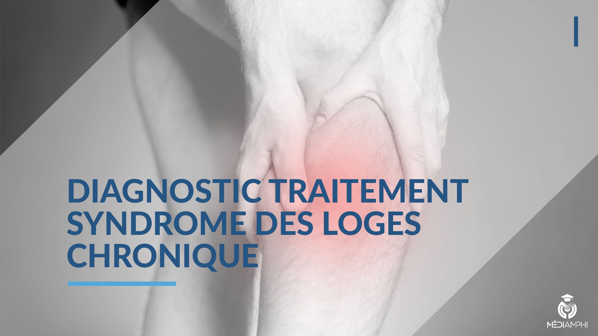 Consensus Clinique Du Diagnostic Et Du Traitement Du Syndrome Des Loges