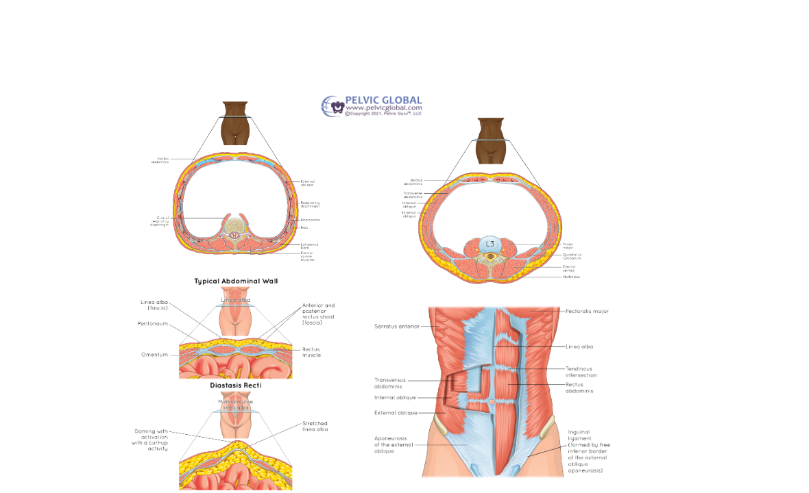 Abdominals, Abdominal Wall & Trunk Cross Sections, Diastasis Recti, DRA ...