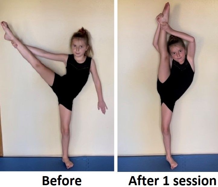 Young dancer holding leg out to side above hip in before pic. After pic she's able to hold leg up by her ear