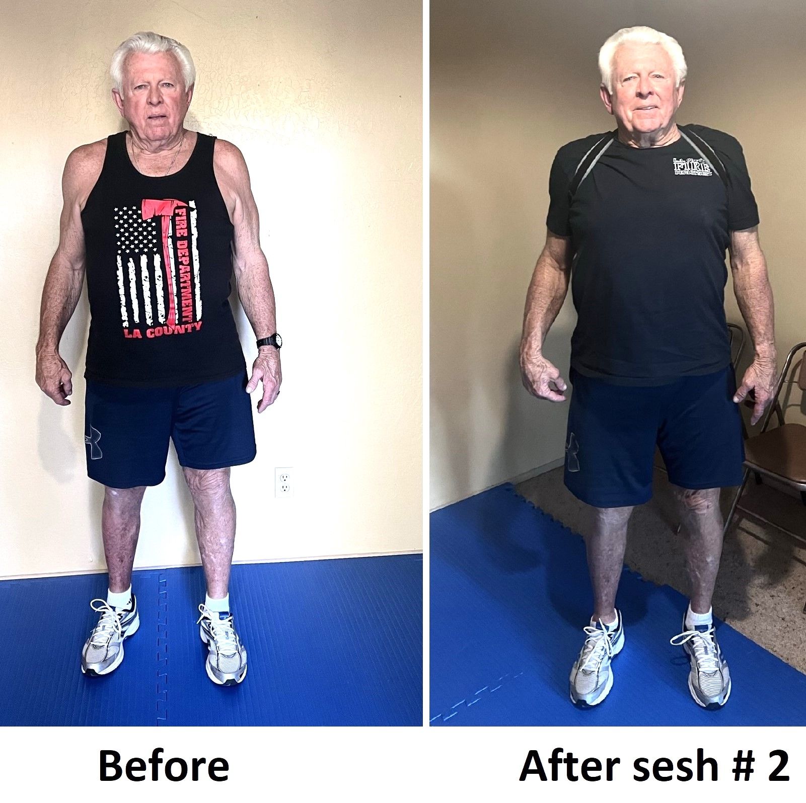 Before and after older man has improved posture and no longer leaning over to one side