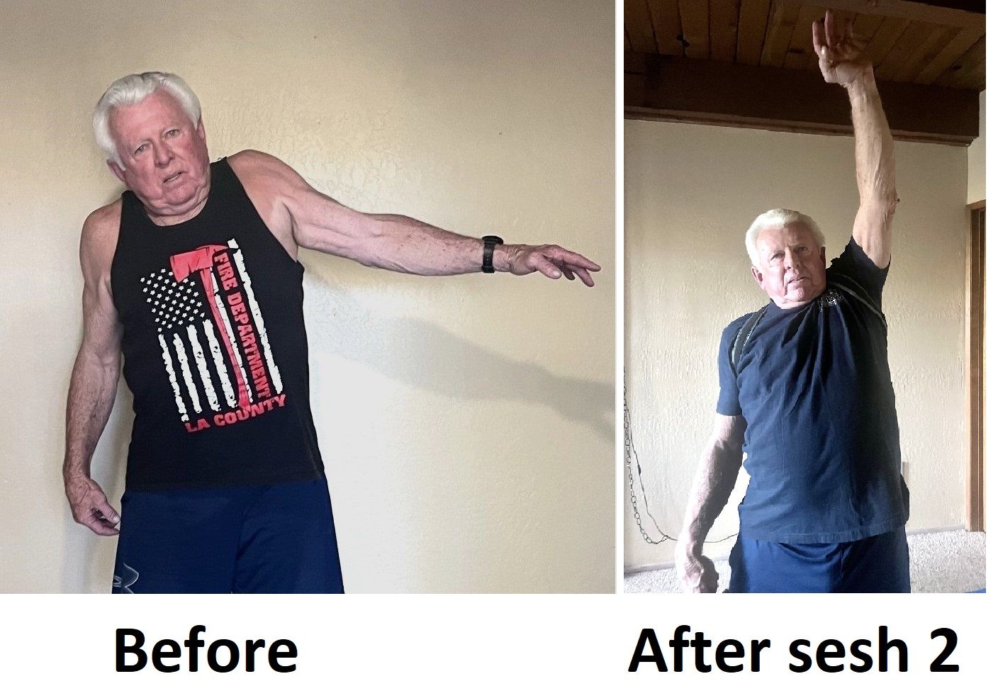 Older man able to lift arm after torn rotator cuff