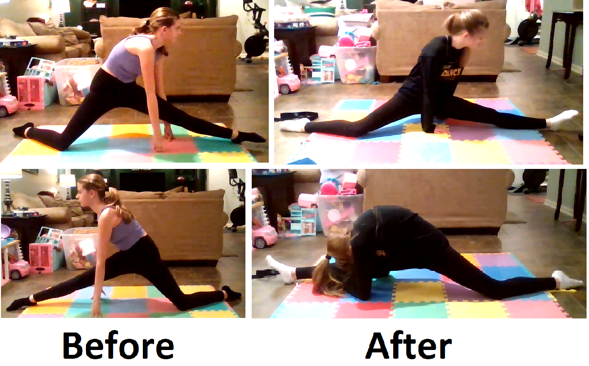 Before and after massive flexibility progress getting into the splits 
