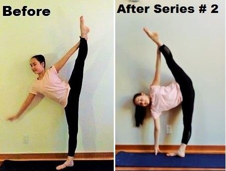 Before & After rhythmic gymnast is able to hold leg much higher in after pic & also can now reach 1 hand to the floor in a full tilt 