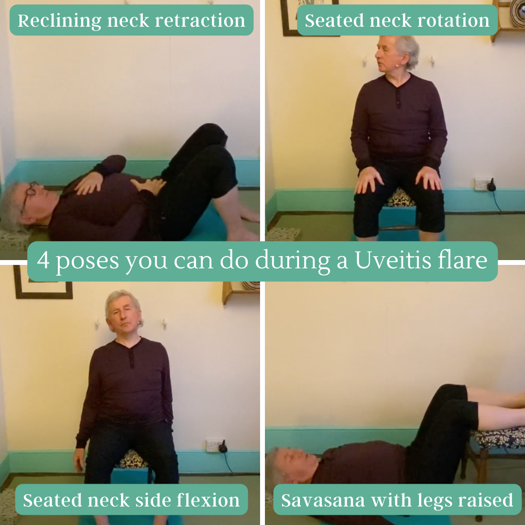 Man doing gentle yoga during a Uveitis flare